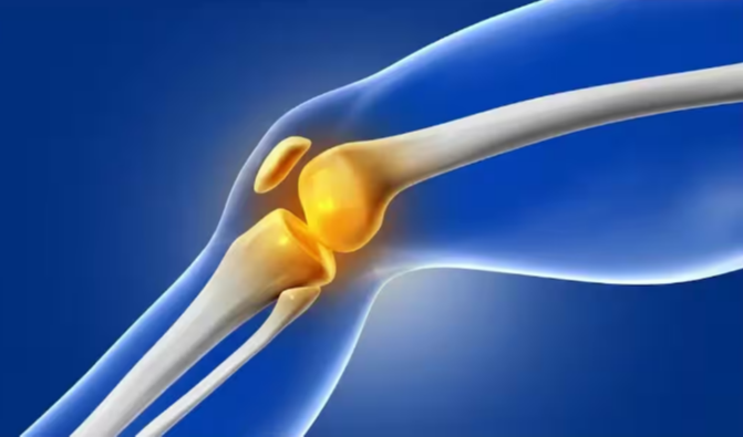 Bone Density : ఎముకలు బలంగా ఉండాలంటే ఏం చేయాలి? బోన్ డెన్సిటీ తగ్గకుండా తీసుకోవాల్సిన జాగ్రత్తలివే